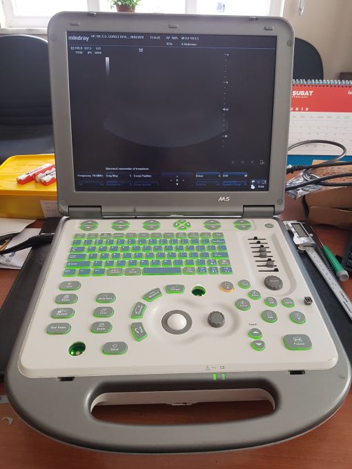 Ultrason tuş üretimi - önce